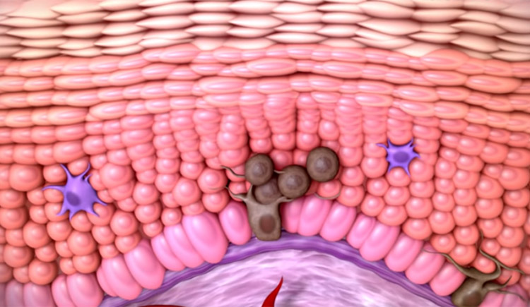Cancer Immunotherapy